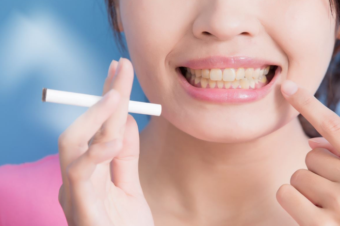 How Does Smoking Affect Oral Health